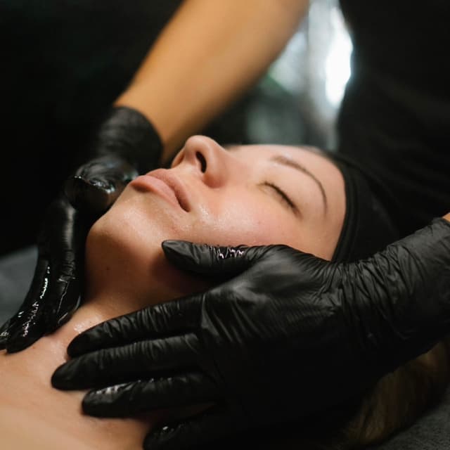 Clear Skin Acne Peel Series of 3 at Starlace Wax & Spa in Hutto, TX